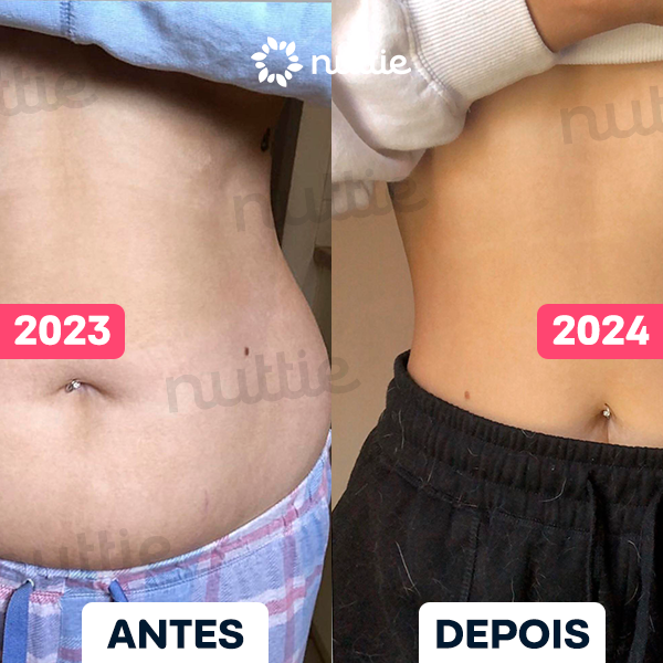 ANTES-E-DEPOIS-2